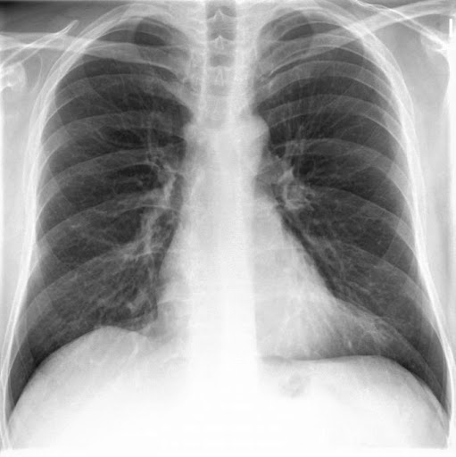 Radiologie Norderstedt Dres. Lemke Krüger Schreiter mit Kernspin MRT Mammographie CT DXA Röntgen - Thumbnail