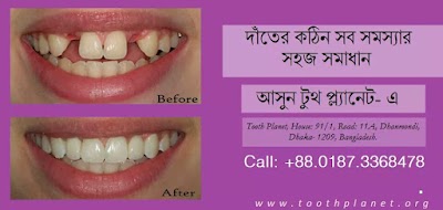 Photos of Tooth Planet