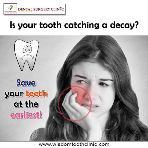 Tooth decay can lead to severe pain and complications if left untreated. If you're experiencing d… post image