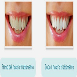 Studio Dentistico Dott. Piera Pesce - Thumbnail