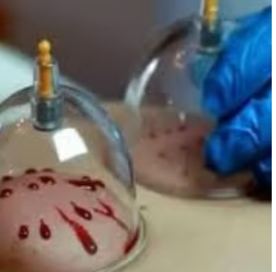 Purecups Wellness Therapy