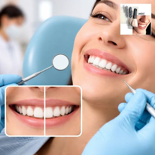 Wondering how a simple gum procedure can transform your smile and improve dental health? Crown le…