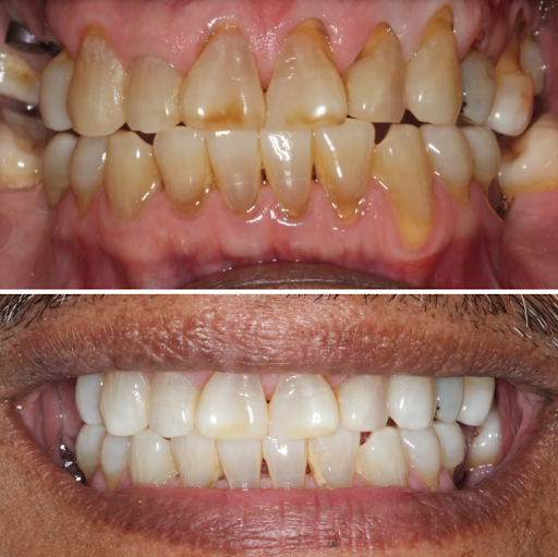 The Dental Equation of Mamaroneck