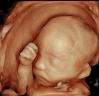 日鋼記念病院産婦人科