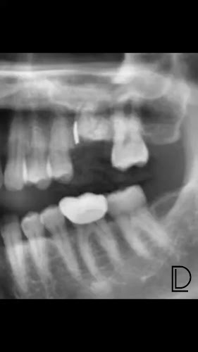 Opinii despre Dental Lounge (Choa Chu Kang) – formerly Quek and Me Dental Surgery în Singapore - Dentist