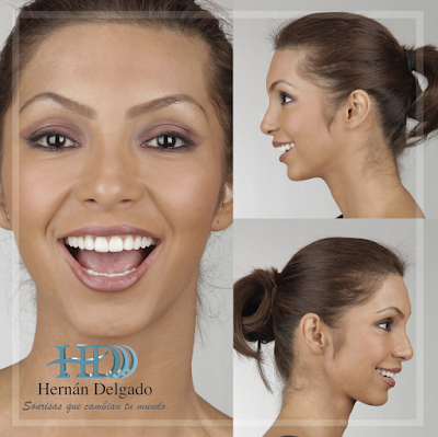 Photos of Hern&aacute;n Delgado Spa Dental