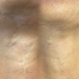 Photo n°22 de Anna Dermo Maquillage Permanent à Carqueiranne (Clinique de maquillage permanent)