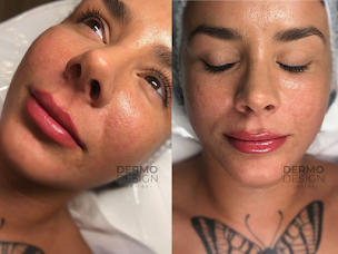 Photo n°15 de DERMODESIGN LILLE à Lille (Service de détatouage)