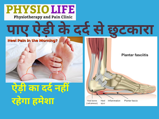 In Heel Pain Physical discomfort on the back or the underside of the heel that may make walking u… post image