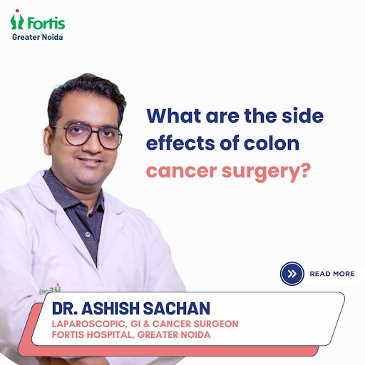 Colon cancer surgery, such as a colectomy or colorectal resection, is an effective treatment but… post image