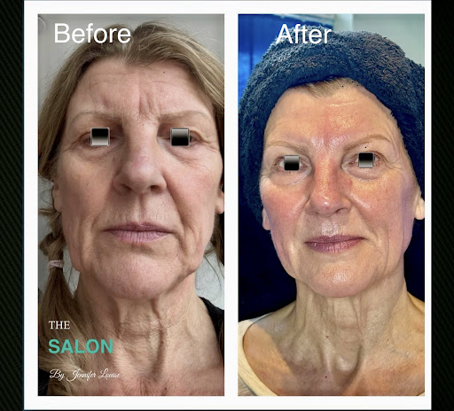 The Salon by jennifer louise ltd & advanced laser and aesthetics clinic