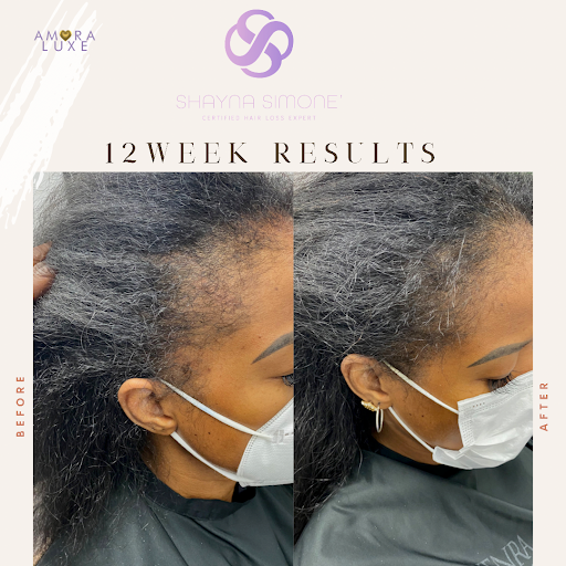 Shayna Simone', Certified Hair Loss Expert - Thumbnail