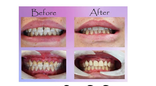 ✨ Transform Your Smile with Expert Dental Care at Revive Face Dental Clinic ✨ post image