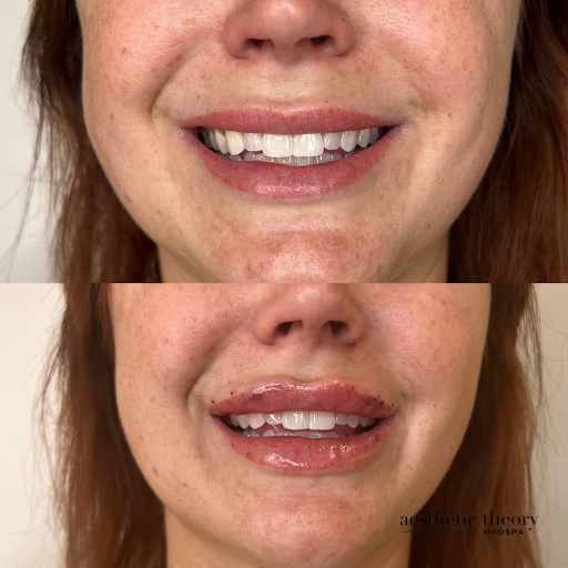 Aesthetic Theory Medspa