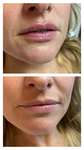 Nova MedSpa
