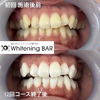 ホワイトニングバー仙台店