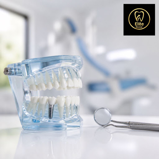 Missing a tooth and don’t want to wait months for a replacement? At Elite dental clinic in Guru N… post image
