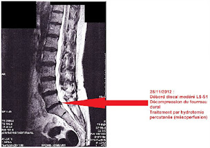Photo n°6 de Centre d’hydro Naturo Thérapie de Marseille à Marseille (Cabinet infirmier)