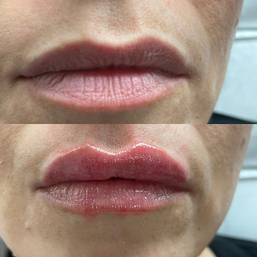 Bio-Skin Med|Aesthetics