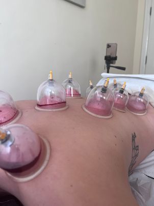 Physio Clinic Wrexham - Thumbnail