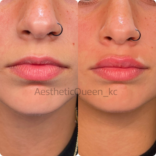 Blush Aesthetic Bar