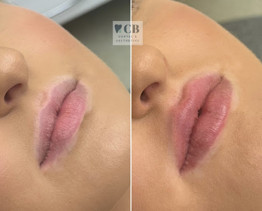 CB Aesthetics Pembrokeshire