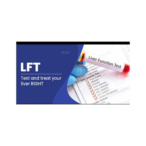 LFT ( Liver Function Test ) post image