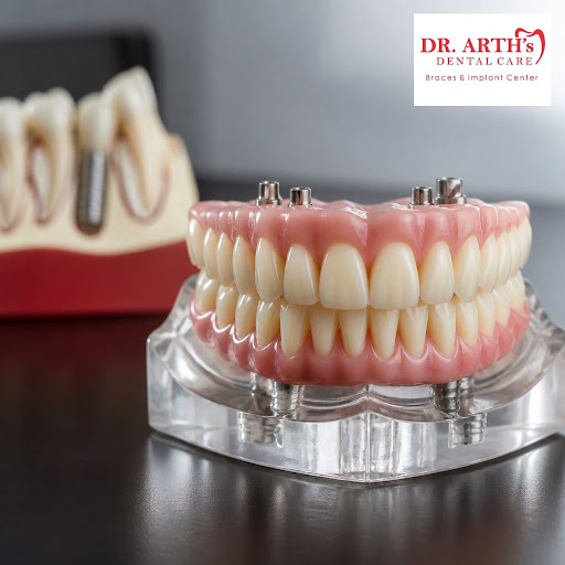 Struggling with missing, damaged or worn-out teeth? Full mouth rehabilitation at Dr Arths Dental… post image
