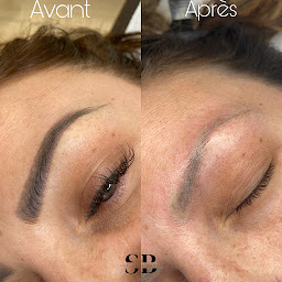 Photo n°5 de LUMEA DEPIL à Six-Fours-les-Plages (Centre d'épilation laser)