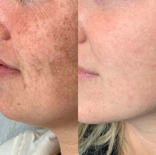 Best Cosmetologist In Mansarovar

#LUMINASKIN&AESTHETICCLINI