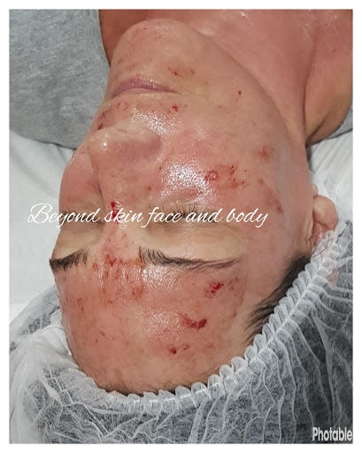 Beyond Skin Face and Body - Thumbnail