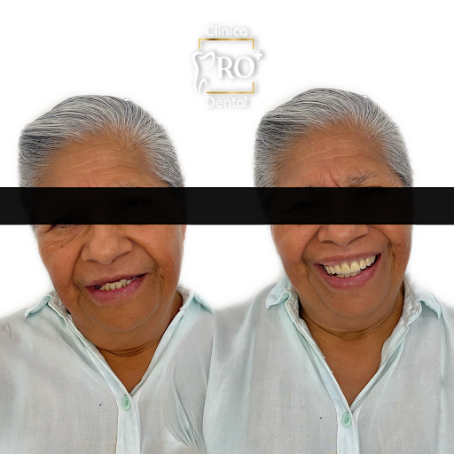 Consultorio Dental “Pro” Dra. Yoselin Bandala - Thumbnail