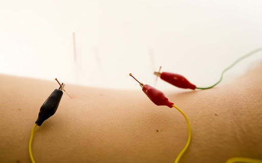 Naturally Appointed Acupuncture and Holistic Wellness Clinic Gallery - United States