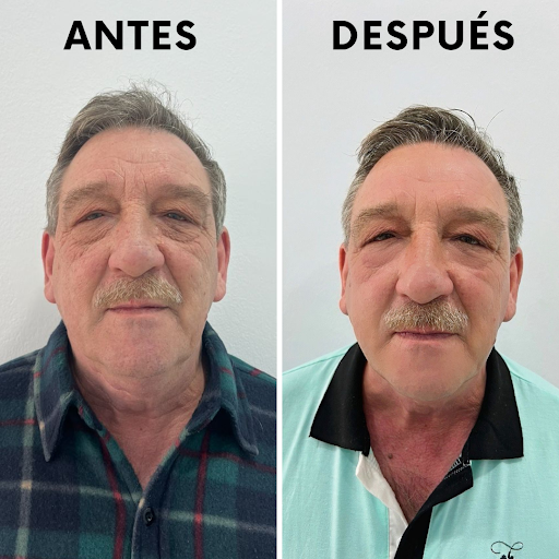 Centro de Depilación y Estética Oni Esthetic No+vello - Thumbnail