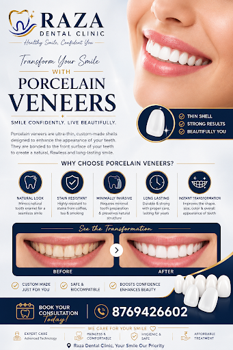 ✨ Transform Your Smile with Porcelain Veneers ✨ post image