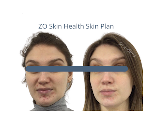 Photo n°12 de Revelance Esthetic à Montpellier (Programme de bien-être)