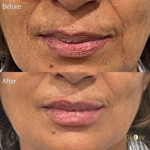 Glow Aesthetic Center Med Spa