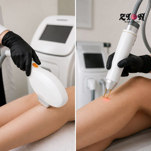 Wondering whether to choose IPL or laser hair removal for smooth, hair-free skin? At ZION AESTHET… post image