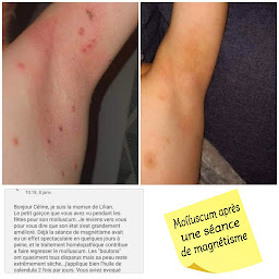 Photo n°7 de Guérisseuse du Born/Magnétiseuse-Coupeuse de feu/Naturopathe/Iridologue/Géobiologue/Céline Duvigneau à Mimizan (Praticien de médecine alternative)