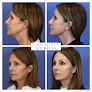 Hair transplant clinic John Bitner Md in Layton