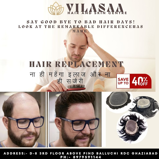 HAIR REPLACMENT SAVE UPTO 40% OFF
