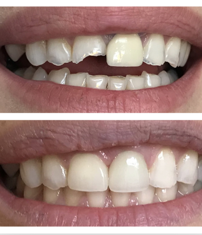 Courtyard Dentistry: Nicholas Gih, DDS - Thumbnail