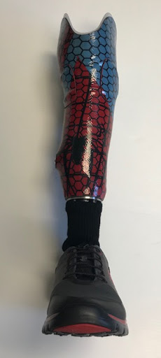 Mobility Solutions Prosthetics and Orthotics - Thumbnail