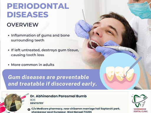 Periodontal diseases, commonly known as gum diseases, are a group of conditions that affect the t… post image