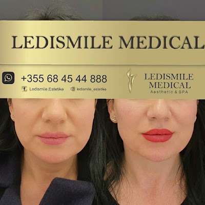 Klinikë estetike Ledismile Medical - Aesthetic & SPA