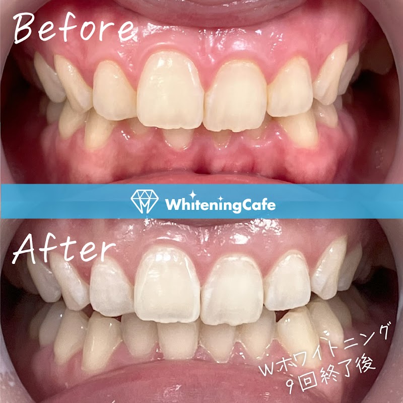 ホワイトニングカフェアスピア明石店