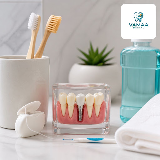 Dental implants are a long-term investment in your smile and oral health. At Vamaa Dental Clinic…