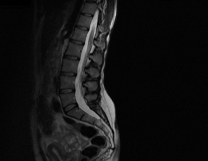 dr n. med. Joanna Urbanowska specjalista neurochirurg gabinet prywatny Wrocław, Author: dr n. med. Joanna Urbanowska specjalista neurochirurg gabinet prywatny Wrocław