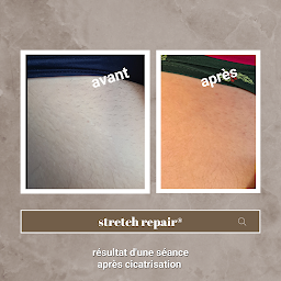 Photo n°7 de Centre dermo-correctiob et Phibrows à Ajaccio (Clinique de maquillage permanent)