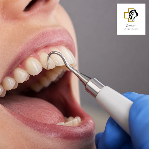 Healthy gums are the foundation of a confident smile. At Renew Aesthetics and Renew Dental in Roy… post image